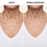 La Crème Anti-Tâches Éclaircissante Sandrine™ — visuel 2