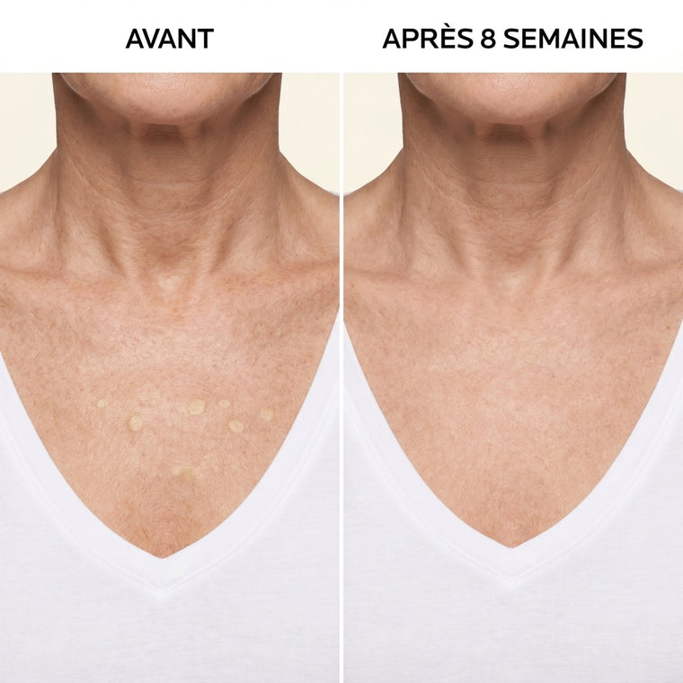 La Crème Anti-Tâches Éclaircissante Sandrine™